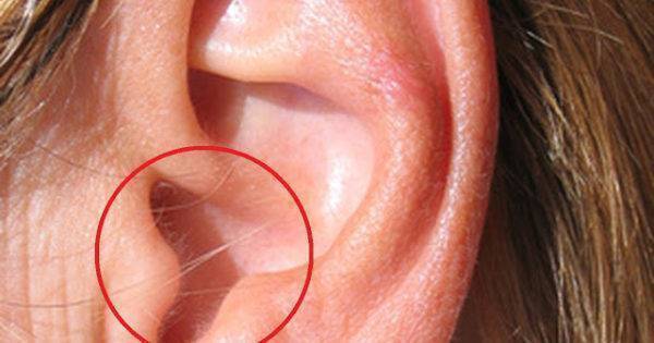 Having hair in your ears might be a bad sign -- and not just because it's a little unsightly.