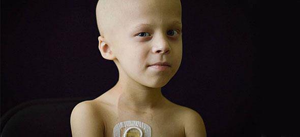 Αποτέλεσμα εικόνας για καρκίνος παιδί Χριστούγεννα