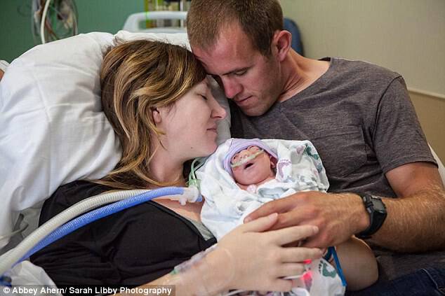 'Incompatible with life': Abbey and Robert Ahern, both 34, made the agonizing decision to go ahead with the birth of their terminally-ill baby Annie, pictured with her parents