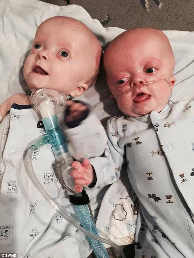 Aw! The nurse was asked by Protective Child Services if she would be willing to adopt one of the twins, but she said she would never separate them and adopted both