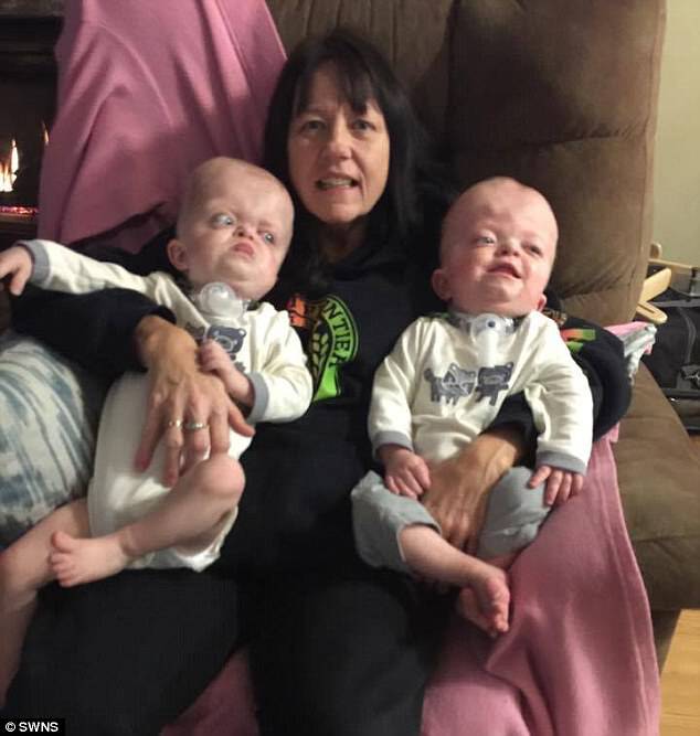 A full-time job: Linda has to tuck the twins tight at night so they don't accidentally remove their breathing tubes in the middle of the night
