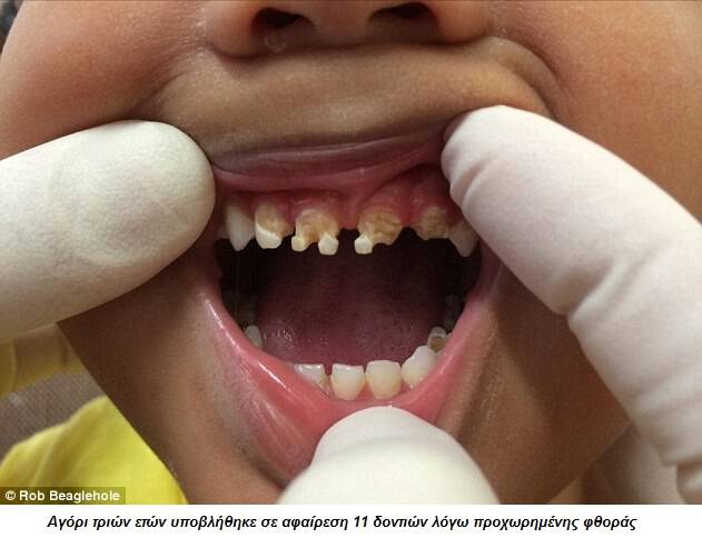 2D6CF9FB00000578 3271670 A three year old boy underwent a major dental operation to have a 18 1445002229560