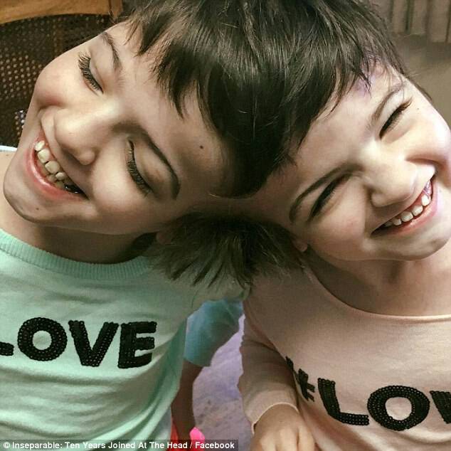 For ten years, conjoined twins, Tatiana and Krista Hogan (pictured), who share a brain and a skull, have defied their doctors' expectations, and now their miraculous story has been featured in a new documentary