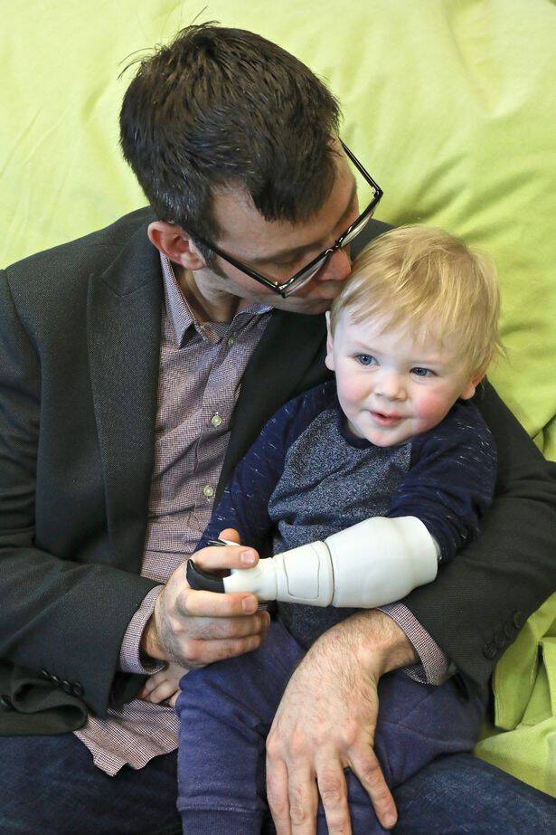 Sol Ryan and dad Ben, who designed a bionic limb