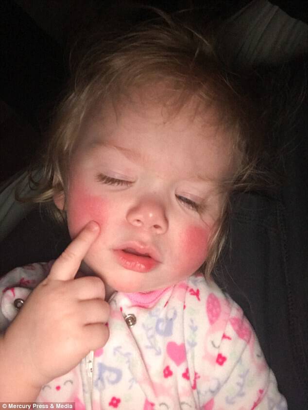Ivy's mother says she has to teach the youngster not to cry (pictured after a reaction)