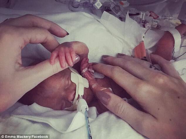 The two mums faced an agonising wait to see if their child would pull through after she was born three months early