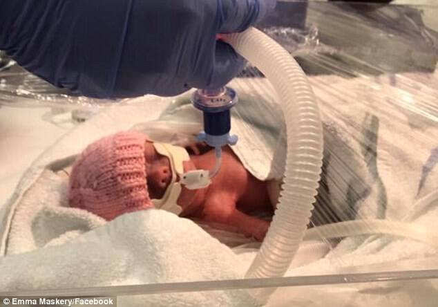 After being diagnosed with preeclampsia, an emergency C-section was performed and the couple's daughter, Roux was successfully delivered on September 16