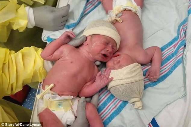 The twins, namedÂ Weston and Caleb Lyman are from Orlando, Florida and were captured on camera by their dad Dane shortly after their birth on February 28