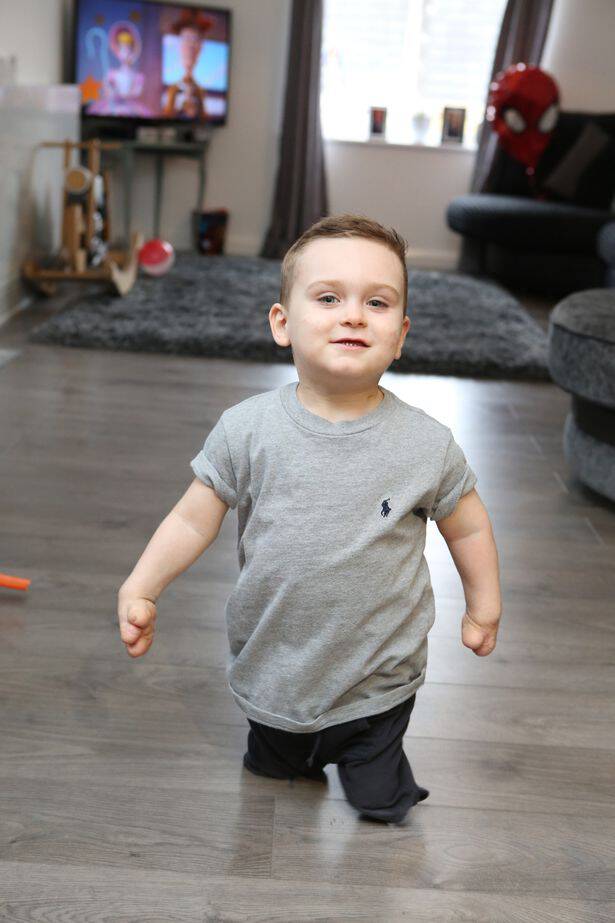 3χρονος που έχασε τα πόδια του από μηνιγγίτιδα έκανε τα πρώτα του βήματα με προσθετικά άκρα - Εικόνα 1