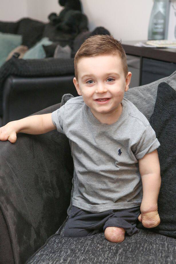 3χρονος που έχασε τα πόδια του από μηνιγγίτιδα έκανε τα πρώτα του βήματα με προσθετικά άκρα - Εικόνα 7