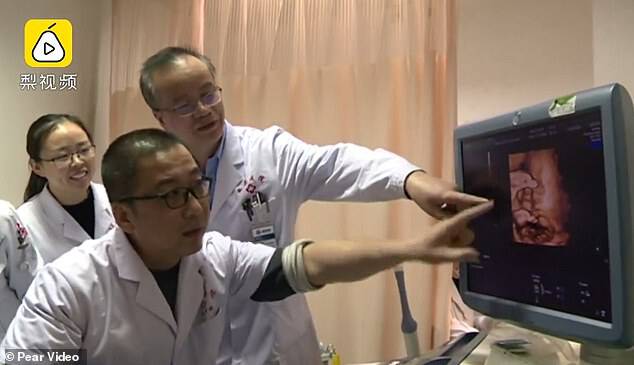 A team of nearly 40 doctors from a dozen departments at the Xijing Hospital participated in the womb transplant for Ms Yang in 2015. The operation was assisted by a robot. Pictured, doctors look at the scan of the unborn boy during an antenatal appointment of Ms Yang