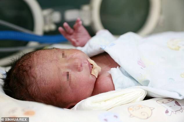 Yang Hua, 26, who was born with no womb and no vagina has become the first woman in China - and the 14th in the world - to give birth to a baby (pictured) after having a uterus transplanted