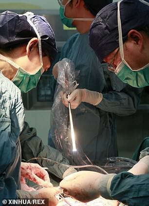 Doctors perform a cesarean operation on Ms Yang who has successfully received a womb at the Xijing Hospital