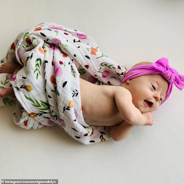 Beautiful baby:Â In honor of their daughter Gwendolyn turning two months old, Jessica wrote a heartwarming 'review' of having a child with Down's syndrome